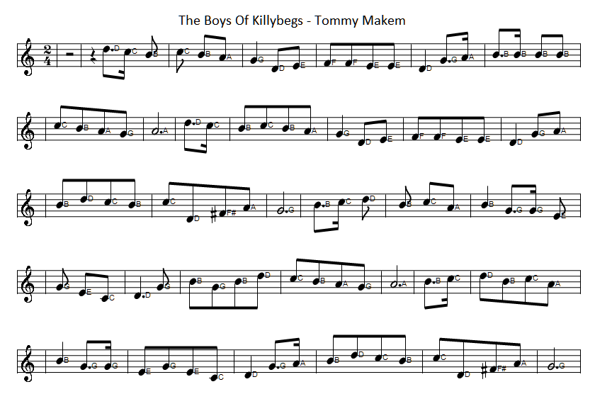 the boys of killybegs sheet music